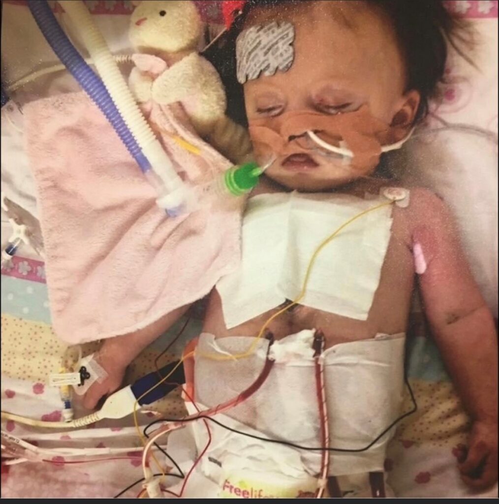 Elodie awaiting transplant